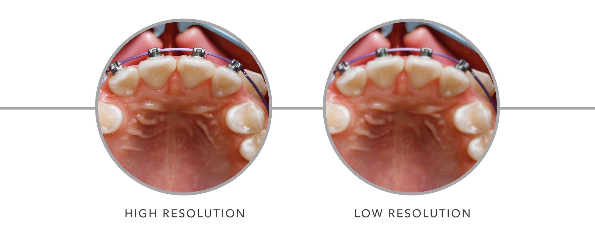 5 Things To Look For When Buying Dental Loupes Optident